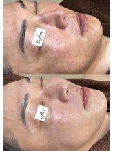 レシェルサロン(Lechelle Salon)/ダクトピール