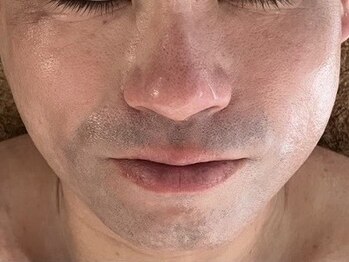 メナードフェイシャルサロン 岐阜茜部の写真/【岐阜】メンズ小顔矯正でシャープな輪郭へ！小顔矯正×毛穴洗浄で、清潔感あふれるデキる男の好印象顔に◎