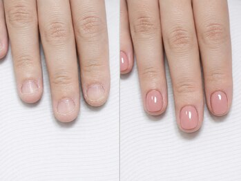 アフローディアネイル ネオ 葛西店(aphloadia nail neo)の写真/【深爪・巻き爪ケア取扱店】自爪を育てる本格ケア★朝9時～営業！メンズ・爪悩み初心者さんも大歓迎◎