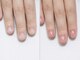 アフローディアネイル ネオ 葛西店(aphloadia nail neo)の写真/【深爪・巻き爪ケア取扱店】自爪を育てる本格ケア★朝9時～営業！メンズ・爪悩み初心者さんも大歓迎◎