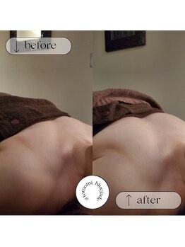 ブルー ジェイド(BLUE JADE)/筋膜リリースbefore　after