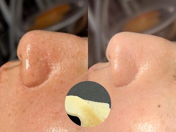 ルーナジェーナ(Luna llena)/池袋 エステ ルーナジェーナ