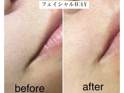 ダリア(Dahlia)の写真