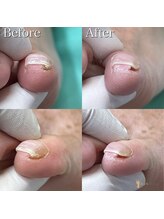 巻き爪補正店 鎌倉大船店/