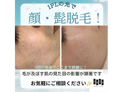 ココ(COCO)の写真