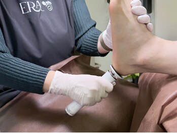 【巻き爪　魚の目　たこ　フットケア専門店】ERAC　エラック　大阪本店の写真/【ガサガサ足卒業】贅沢フットシャンプー+美容液+専用マシンで驚きの仕上がり。滑らかでつるふわの足へ。