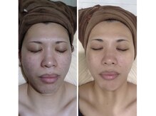 ミーフォレスト(Mi Forest)/