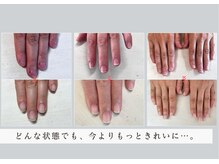 ヴェールリム(verl lim)の雰囲気（深爪根本改善から爪の形のコンプレックスまでお任せください！）