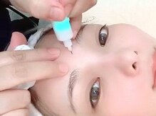 クラティス(CRATIS)/【ピンポイントシミケア】