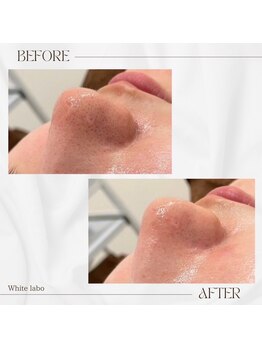 ホワイトラボ 梅田(White labo)/韓国ツヤ美肌☆オルチャン肌に♪