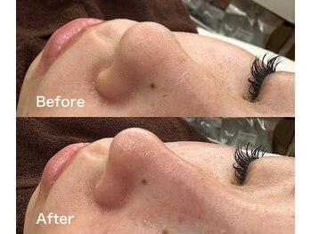 ワイイーサロン(Y/E SALON)/【初回3850円～】