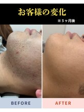 ジェントル(GENTLE)/お客様の変化