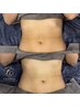 【2回目以降の方】レモンボトルでくびれ作りマッサージ付【横腹or腰回り】8cc