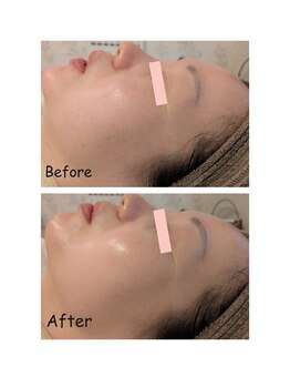 イロドリ(irodori)/悩み別美容液導入♪