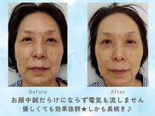 至空院の雰囲気（初めての方も安心♪とにかく優しい美容鍼★）