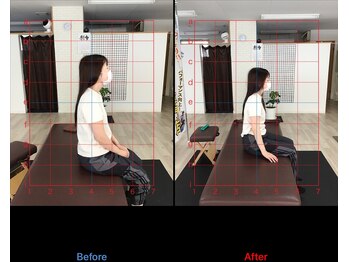 ストレチックス 近江八幡店/ストレッチ ビフォーアフター