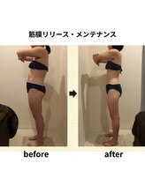 クリア(Clear)/筋膜リリース・メンテナンス