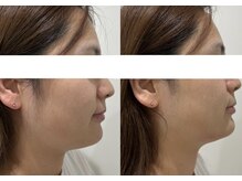 ラブリエ(La Briller)