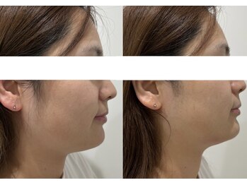 ラブリエ(La Briller)