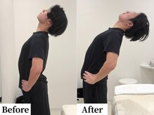 ソレア(Solea)/腰痛・反り腰改善1回目