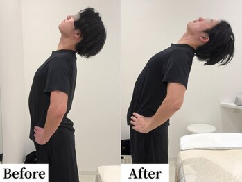 ソレア(Solea)/腰痛・反り腰改善1回目