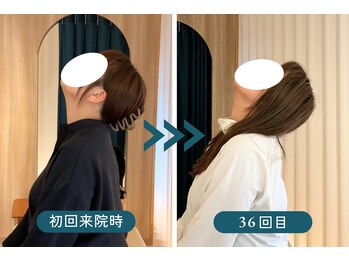 リリーフポート 大手町店/施術での結果