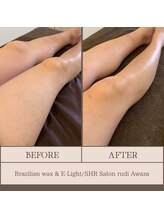 ルディ 阿波座店(rudi)/脚ALL　ワックス＆SHR光脱毛