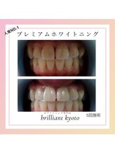 ブリリアント 京都店(Brilliant)/他店にない本格ホワイトニング！