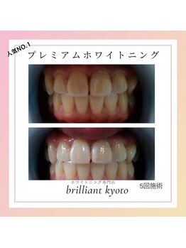 ブリリアント 京都店(Brilliant)/他店にない本格ホワイトニング！