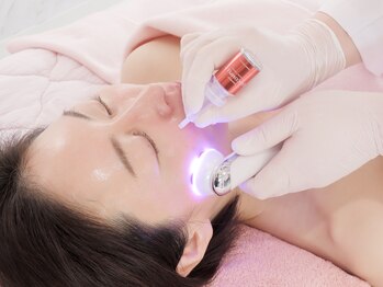 スフィア(Sphere)/最先端のエクソソーム