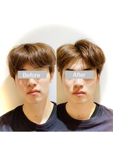 ワカヤマ 小顔(Wakayama)/★Before・After★