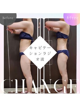 プリオール 太田店(Prior)/キャビテーションラジオ波