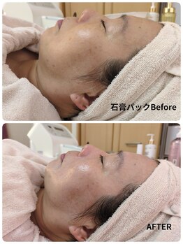 ラヴィアンローズ 蒲郡店(& La vie en Rose)/石膏パック