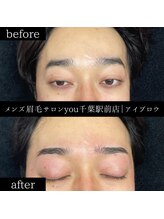 ユー 千葉駅前店(you)/ビフォ－アフター写真