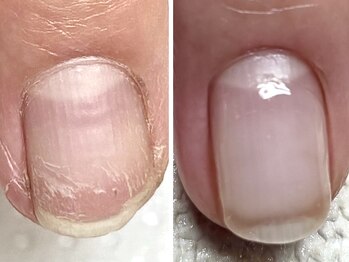 カランコエ(Kalanchoe)の写真/爪×ライフスタイル×性格の組み合わせであなたに合わせた地爪育成内容をご提案◇お悩みご相談ください◎