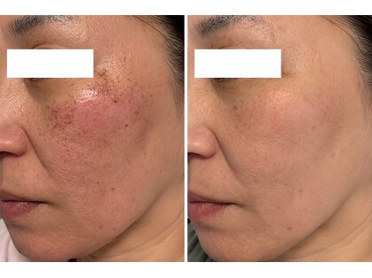 スキンラボプラス(SKIN LABO +)の写真