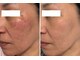 スキンラボプラス(SKIN LABO +)の写真