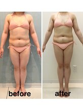 アールボディバランス/【3ヶ月モニター様】