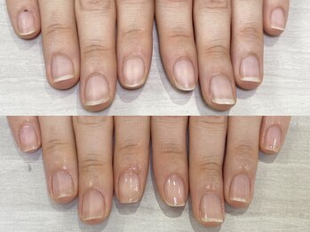 自爪育成３ヵ月コース