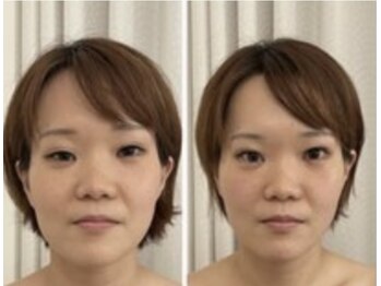 美人バスト 岡崎店/お顔の大きさ変わっちゃいます！