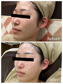 ジャスミン(Jasmin)/ブライダルケア