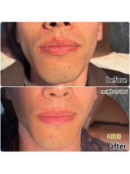 シンバ 倉敷店(SIMBA)/