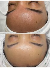 ユミサロン(U Mi Salon)/