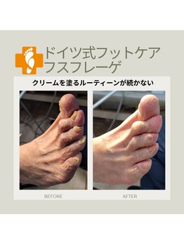 フスフレーゲ 学芸大学店/足裏のお手入れのお悩み