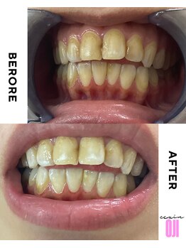 エクシアホワイトニング 王寺店/