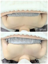 美人バスト 柏店/【バストアップ・育乳】症例