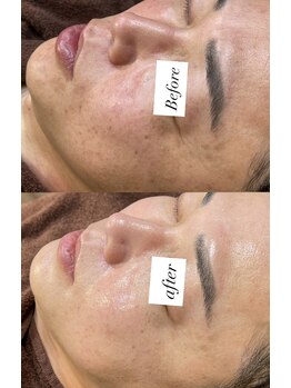 レシェルサロン(Lechelle Salon)/ダクトピール