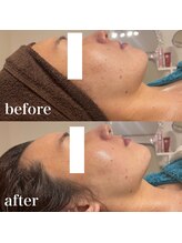 サロン リティナ(Salon Ritina)/むくみも撃退！！