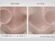 アメリアスキンラボ 天神店(Amelia Skin Lab.)の写真
