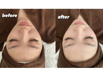 ルラ バイ フリー(RULA by free)/フェイシャルエステ